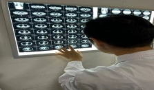 废旧CT片回收，这门生意也能做？ 经济要闻 华声经济