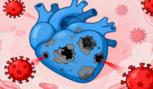 病毒性心肌炎的典型症状：从轻微不适到严重表现