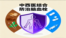 中西医结合防治脑血栓